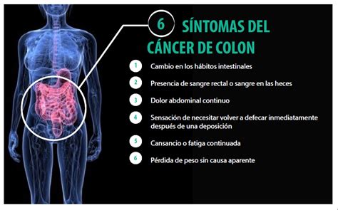 Sintomas del cancer de colon en hombres, Cantitati de ...