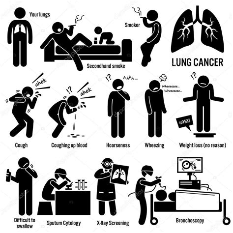 Síntomas del cáncer de pulmón causa factores de riesgo ...