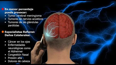 Síntomas tumor cerebral ⊛ ¡Prevención y Tratamiento 2020!