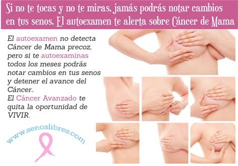 ¿Sirve o no el autoexamen de seno para detectar cáncer ...