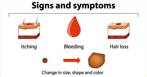 Skin Cancer Early Signs