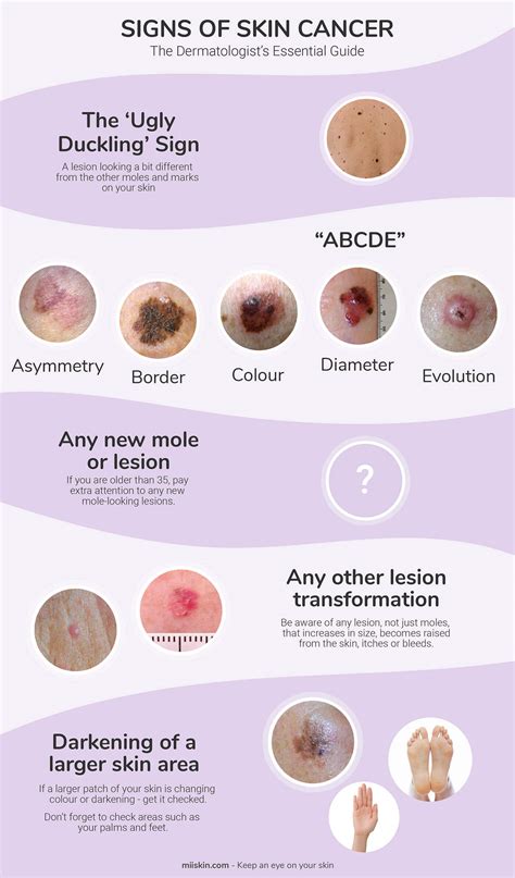 Skin Cancer Signs & Symptoms | The Dermatologist s ...