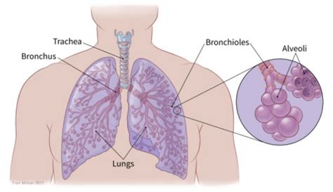 Small Cell Lung Cancer Guide | Understanding SCLC