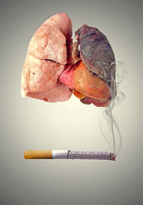 Smoker s Lungs vs. Normal Healthy Lungs