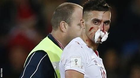 Southampton s Dusan Tadic may need surgery on suspected ...