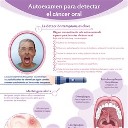 Spanish Oral Cancer Self Exam Infographic PDF  Autoexamen para detectar ...