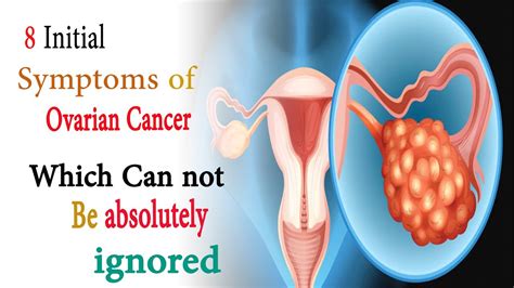 Stages Of Ovarian Cancer Symptoms | 8 initial symptoms of ...
