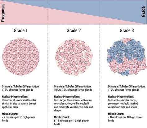 Staging & Grade   Breast Pathology | Johns Hopkins Pathology