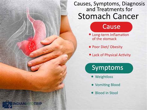 Stomach Cancer   Cause, Symptom, Treatment in India with ...