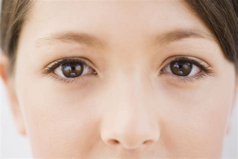 Swollen Eyes   Doctor answers on HealthTap