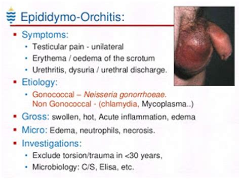 symptom of stds in men