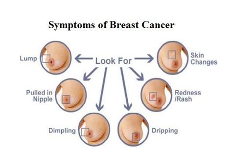 Symptoms and Causes of Breast Cancer | Health and Fitness