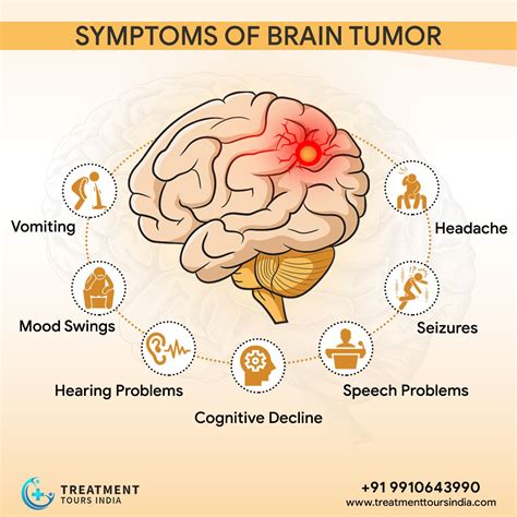Symptoms of Brain Tumor | Brain tumor, Tumor, Best hospitals