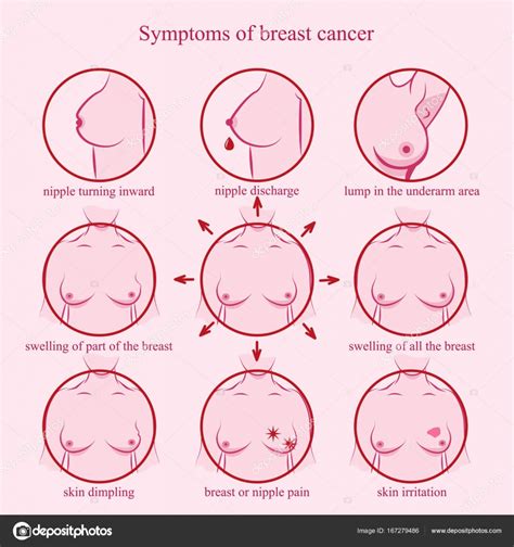 Symptoms of breast cancer. — Stock Vector  nayasha.fant ...