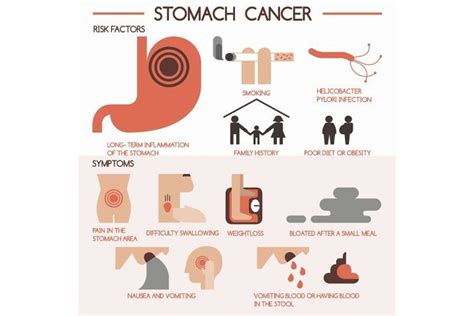 Symptoms Of Gastric Cancer   Cancer News Update