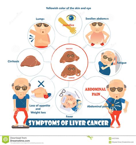 Symptoms of liver cancer stock vector. Illustration of ...