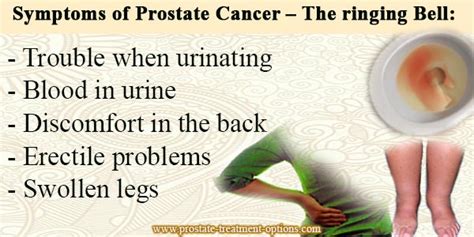 Symptoms of prostate cancer – get to know the symptoms
