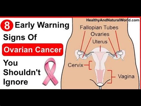Symptoms of Uterine Cancer   Cancer Signs and Symptoms ...