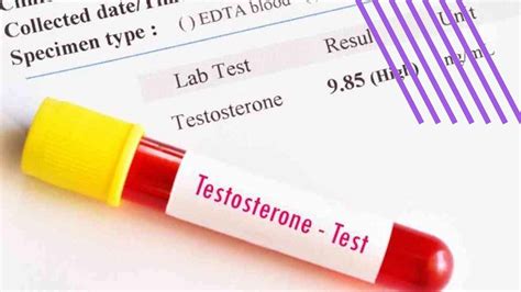 Testosterona alta: un castigo para la mujer, una ventaja para el hombre