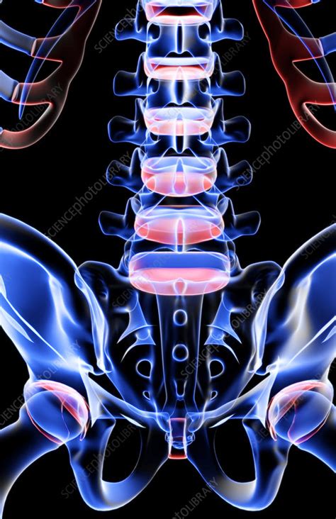 The bones of the lower back   Stock Image   F001/4182 ...