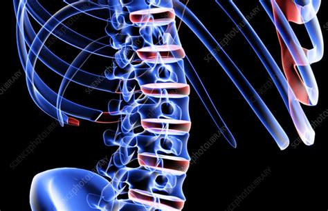 The bones of the lower back   Stock Image   F001/9753 ...