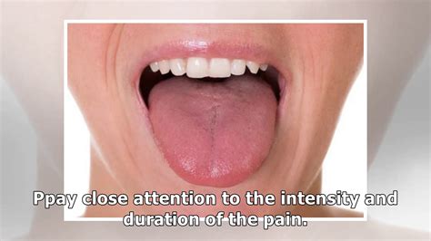 The first symptoms of tongue cancer   YouTube