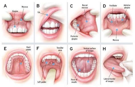 Throat Cancer Symptoms, Risk Factors, Stages and Treatment ...