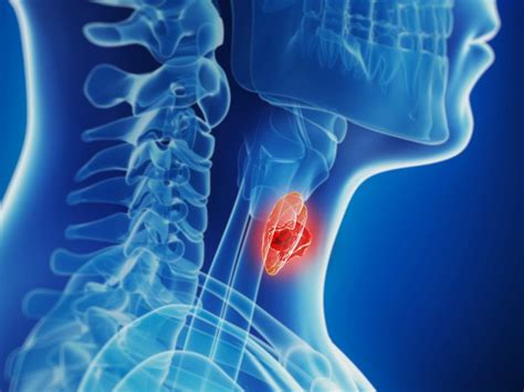 Thyroid Cancer Name Change: Proposal or Done Deal?