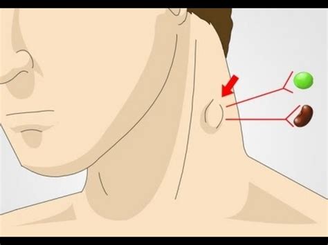 ¿Tienes inflamación en los ganglios linfáticos del cuello?   YouTube
