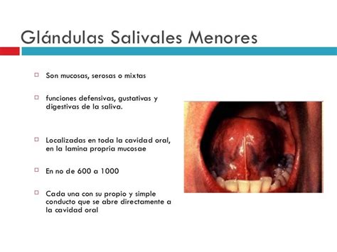 Tipos De Glandulas Salivares   SEONegativo.com