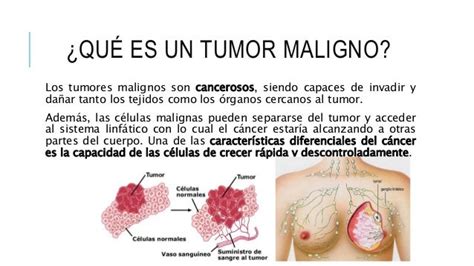 Tipos De Tumores Malignos   SEONegativo.com