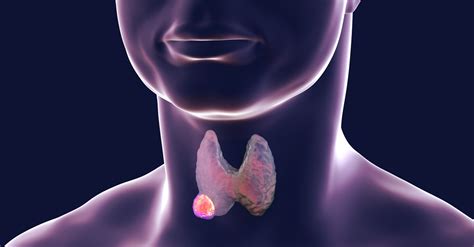 Tiroides, una glandula humana de afeccion frecuente