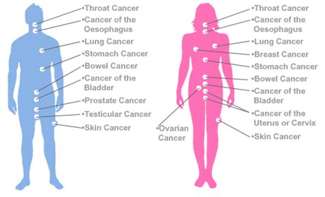 Top 10 Most Common Types of Cancer