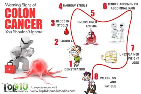 Top 13 Early Warning Signs of Colon Cancer to Beware