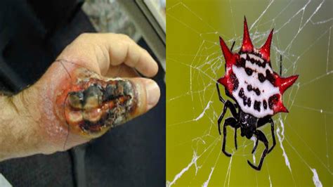 Top 5 arañas mas venenosas   YouTube