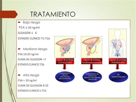 Tratamiento cancer de prostata