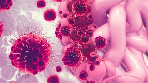 Tratamiento contra el cáncer: qué son las nanocápsulas, la ...