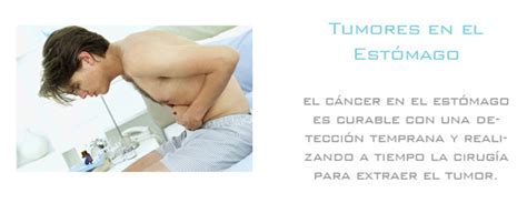Tratamiento de Tumores o Cáncer en el estómago Guadalajara