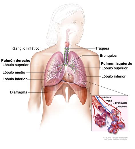 Tratamiento del cáncer de pulmón de células pequeñas  PDQ ...