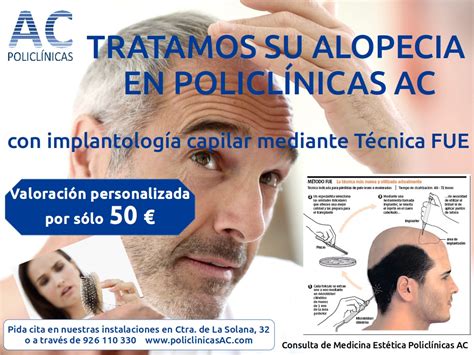 Tratamiento para tratar su alopecia | Policlínicas AC