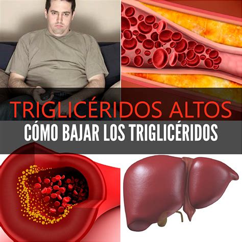 Triglicéridos altos – cómo bajar los triglicéridos | La Guía de las ...