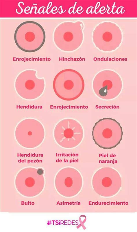 TSiHonduras   12 síntomas del cáncer de mama a los que ...