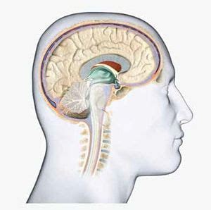 Tumor benigno en el cerebro: Qué es, síntomas, tratamiento ...
