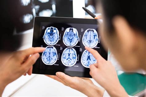 Tumor cerebral: síntomas, diagnóstico y tratamiento