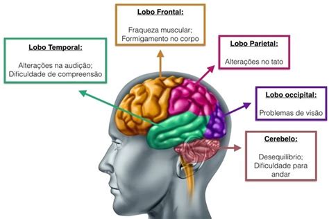 Tumor cerebral: sintomas, tipos e como é feito o ...