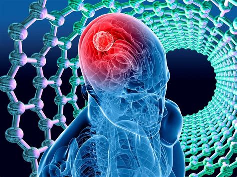 tumor cerebral y sus tipos: Todo lo que debes saber