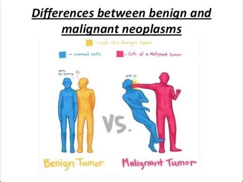 Tumor Types  Benign & Malignant Explained Briefly   YouTube