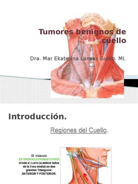 tumores benignos de cuello  1  | Biopsia | Especialidades Medicas