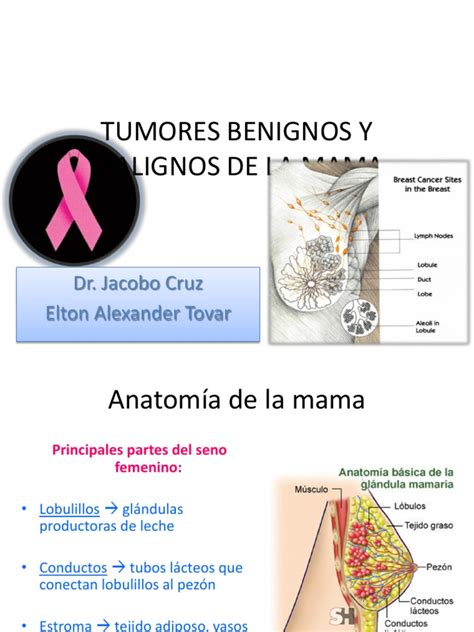 Tumores Benignos de Mama Tanya | Cáncer de mama | Pecho