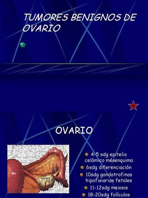 Tumores Benignos de Ovario | Epitelio | Anatomía | Prueba gratuita de ...